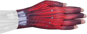 Cyborg Medical Graduated Compression Glove for Lymphedema