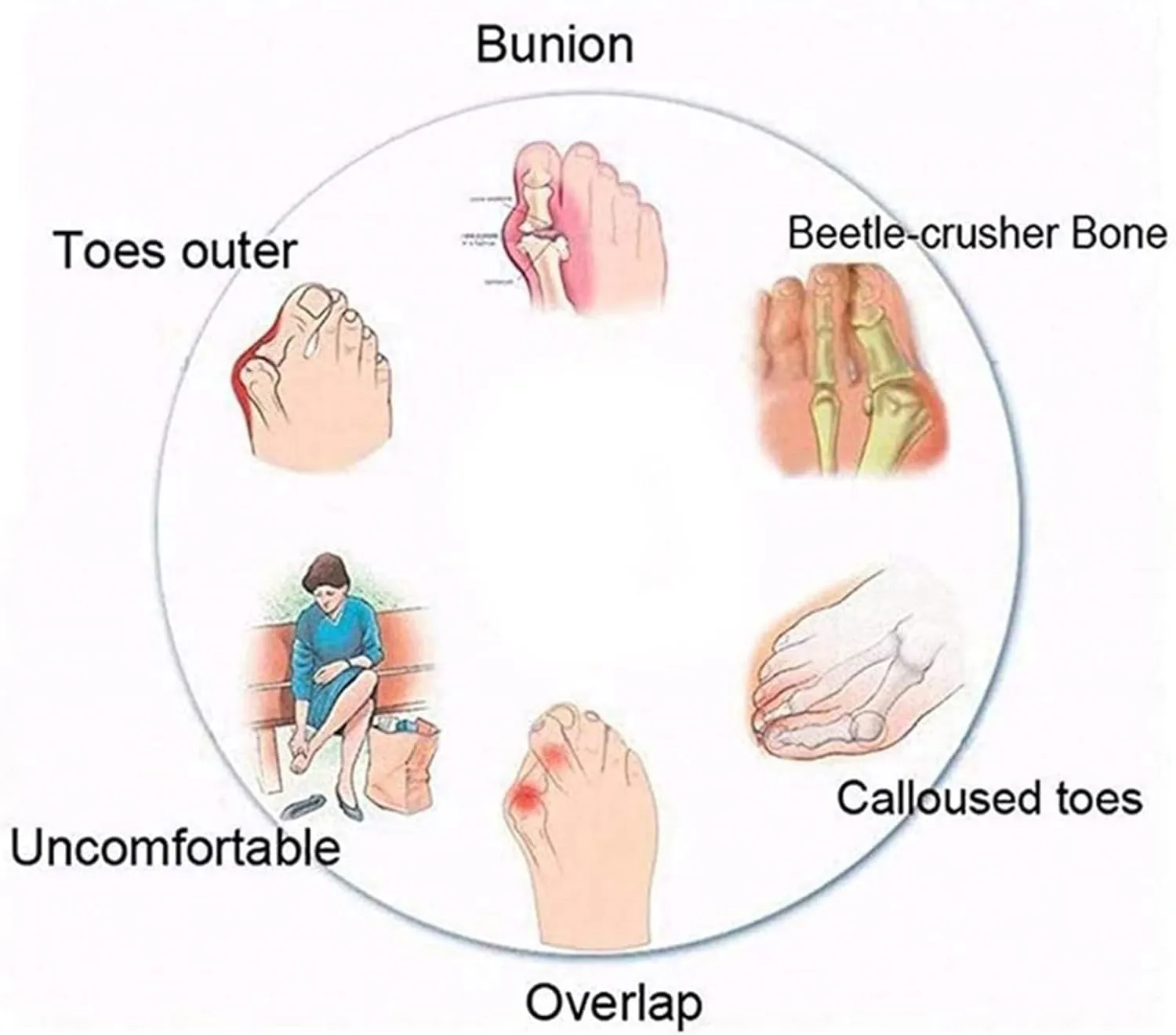 Lightweight Split Toe Bunion Corrector Sandals Men, Summer Breathable Men's Durable Sandals Bunion Relief